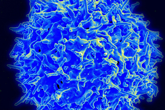 PrudentBiotech.com ~ Healthy T-Cell